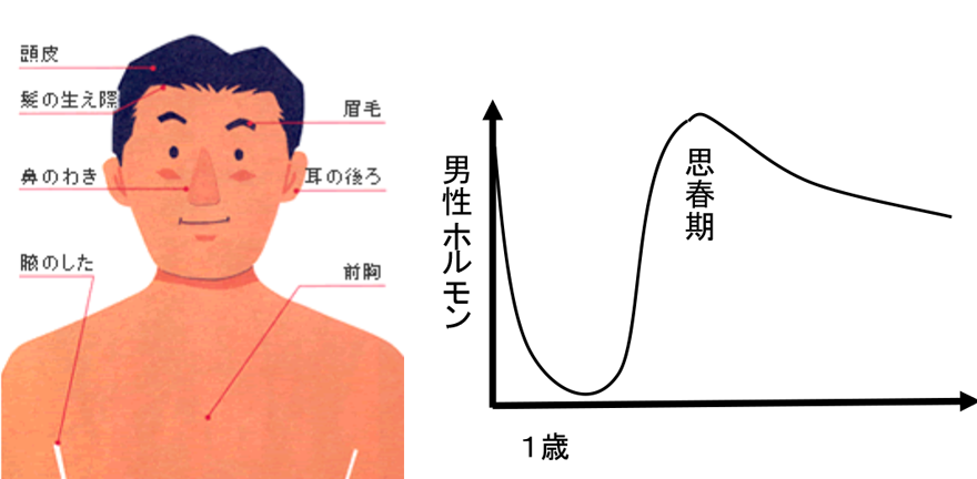 原因と悪化因子イメージ